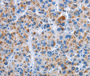 CENPJ Antibody in Immunohistochemistry (Paraffin) (IHC (P))