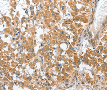 CHMP4B Antibody in Immunohistochemistry (Paraffin) (IHC (P))