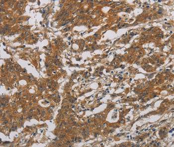 CNDP1 Antibody in Immunohistochemistry (Paraffin) (IHC (P))