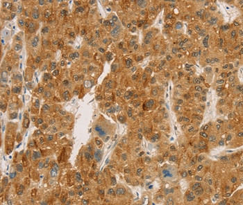 Carboxypeptidase A2 Antibody in Immunohistochemistry (Paraffin) (IHC (P))