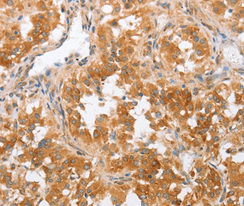 CRELD2 Antibody in Immunohistochemistry (Paraffin) (IHC (P))