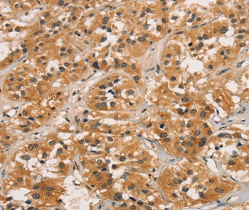 ICAT Antibody in Immunohistochemistry (Paraffin) (IHC (P))