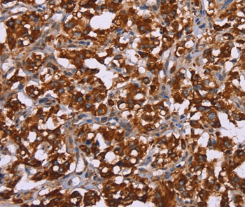 CYP2W1 Antibody in Immunohistochemistry (Paraffin) (IHC (P))