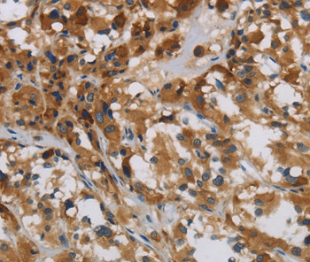 LOXL4 Antibody in Immunohistochemistry (Paraffin) (IHC (P))