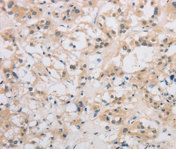 DDIT4L Antibody in Immunohistochemistry (Paraffin) (IHC (P))