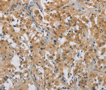 DDX43 Antibody in Immunohistochemistry (Paraffin) (IHC (P))