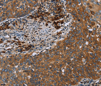 HYAL3 Antibody in Immunohistochemistry (Paraffin) (IHC (P))