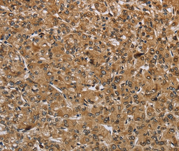 IKBIP Antibody in Immunohistochemistry (Paraffin) (IHC (P))