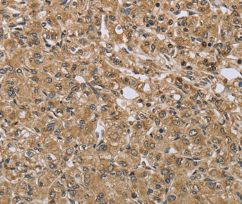 TXLNA Antibody in Immunohistochemistry (Paraffin) (IHC (P))