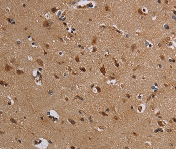 KCNK13 Antibody in Immunohistochemistry (Paraffin) (IHC (P))