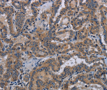 Kallikrein 8 Antibody in Immunohistochemistry (Paraffin) (IHC (P))