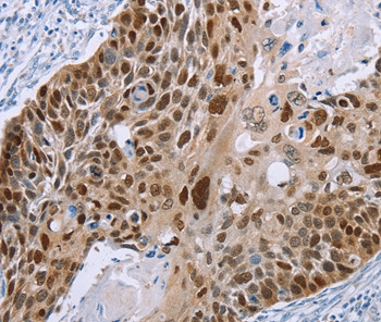 MAGEA10 Antibody in Immunohistochemistry (Paraffin) (IHC (P))