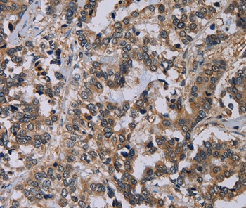 Nectin 4 Antibody in Immunohistochemistry (Paraffin) (IHC (P))