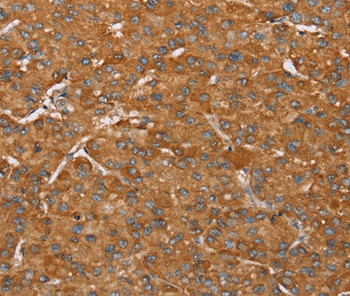 PAGE5 Antibody in Immunohistochemistry (Paraffin) (IHC (P))