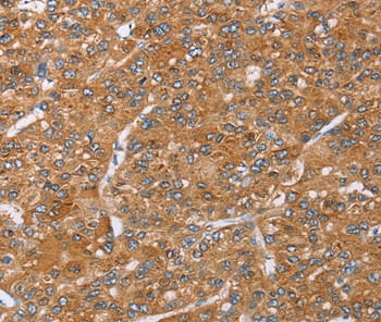 PAICS Antibody in Immunohistochemistry (Paraffin) (IHC (P))