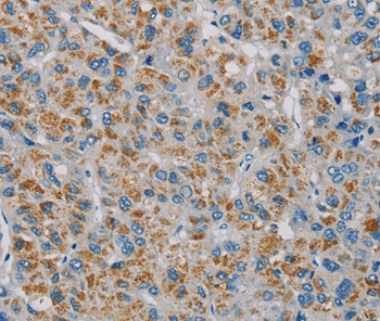 PNLIP Antibody in Immunohistochemistry (Paraffin) (IHC (P))