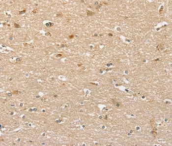 PHLPP1 Antibody in Immunohistochemistry (Paraffin) (IHC (P))