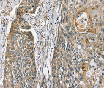 PHLPP1 Antibody in Immunohistochemistry (Paraffin) (IHC (P))