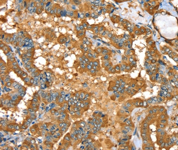 PYGL Antibody in Immunohistochemistry (Paraffin) (IHC (P))