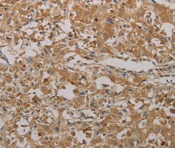 AATK Antibody in Immunohistochemistry (Paraffin) (IHC (P))