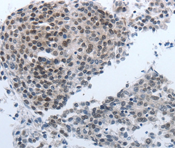 NPR1 Antibody in Immunohistochemistry (Paraffin) (IHC (P))