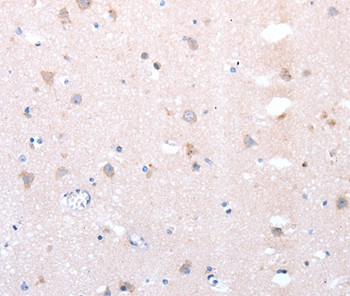 DTX1 Antibody in Immunohistochemistry (Paraffin) (IHC (P))