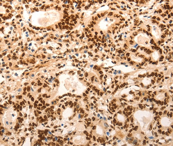 E2F7 Antibody in Immunohistochemistry (Paraffin) (IHC (P))