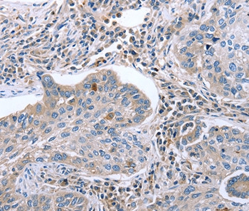 EGR4 Antibody in Immunohistochemistry (Paraffin) (IHC (P))