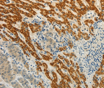 CMTM7 Antibody in Immunohistochemistry (Paraffin) (IHC (P))