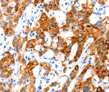 SLC2A11 Antibody in Immunohistochemistry (Paraffin) (IHC (P))