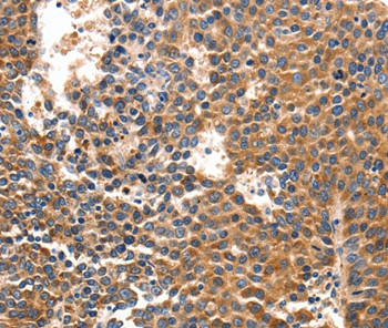 IRF1 Antibody in Immunohistochemistry (Paraffin) (IHC (P))