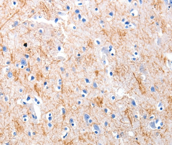 KISS1 Antibody in Immunohistochemistry (Paraffin) (IHC (P))