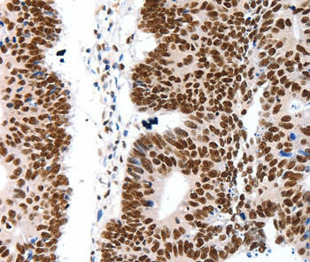 LIFR Antibody in Immunohistochemistry (Paraffin) (IHC (P))