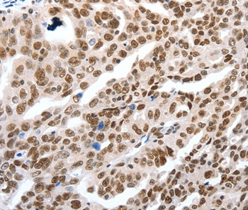 LIFR Antibody in Immunohistochemistry (Paraffin) (IHC (P))