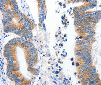 LRP2 Antibody in Immunohistochemistry (Paraffin) (IHC (P))