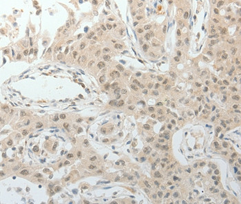 TOP1MT Antibody in Immunohistochemistry (Paraffin) (IHC (P))