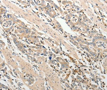 ADAMTS2 Antibody in Immunohistochemistry (Paraffin) (IHC (P))