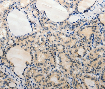 ADAMTS6 Antibody in Immunohistochemistry (Paraffin) (IHC (P))