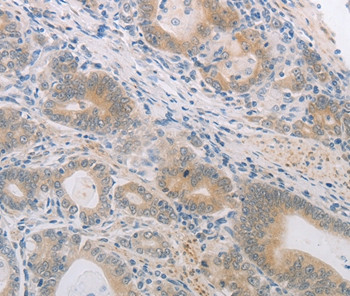 PGA5 Antibody in Immunohistochemistry (Paraffin) (IHC (P))