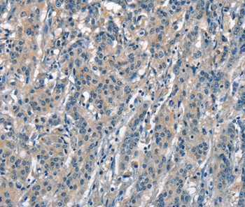 ACPT Antibody in Immunohistochemistry (Paraffin) (IHC (P))