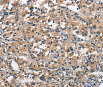 ACPT Antibody in Immunohistochemistry (Paraffin) (IHC (P))