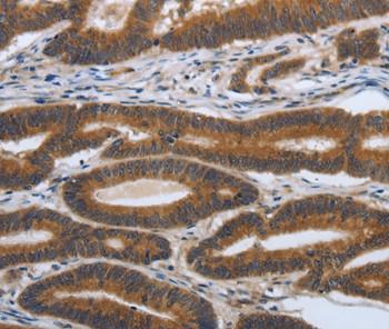 PDGF-A Antibody in Immunohistochemistry (Paraffin) (IHC (P))