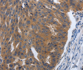 PDGF-A Antibody in Immunohistochemistry (Paraffin) (IHC (P))