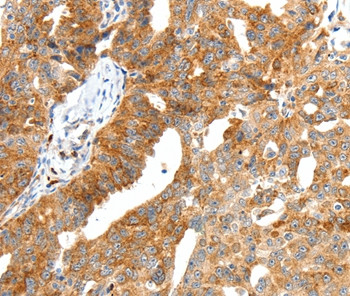 Secretin Antibody in Immunohistochemistry (Paraffin) (IHC (P))