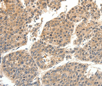 SLC27A1 Antibody in Immunohistochemistry (Paraffin) (IHC (P))