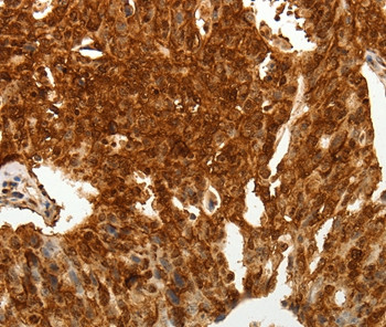 TENM3 Antibody in Immunohistochemistry (Paraffin) (IHC (P))