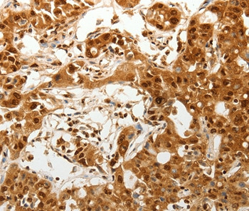 TENM3 Antibody in Immunohistochemistry (Paraffin) (IHC (P))