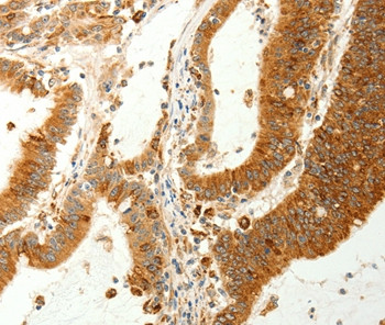 RARRES1 Antibody in Immunohistochemistry (Paraffin) (IHC (P))