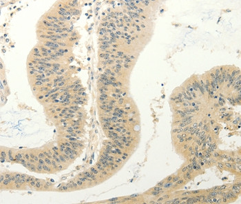 FZD8 Antibody in Immunohistochemistry (Paraffin) (IHC (P))