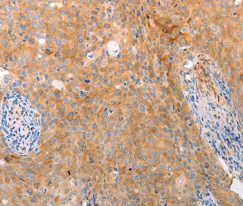 ABCA2 Antibody in Immunohistochemistry (Paraffin) (IHC (P))